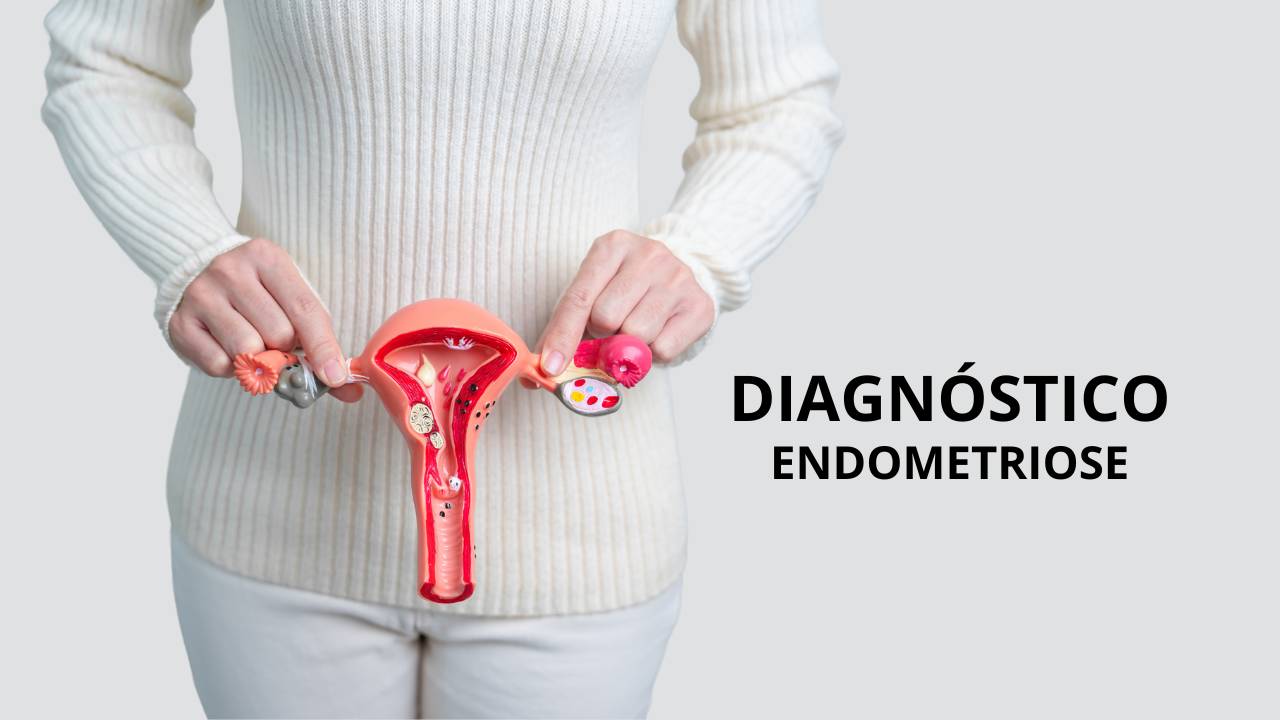 Diagnóstico endometriose por nutricionista.